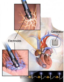 Mercy Angiography > Procedures & Treatments ...
